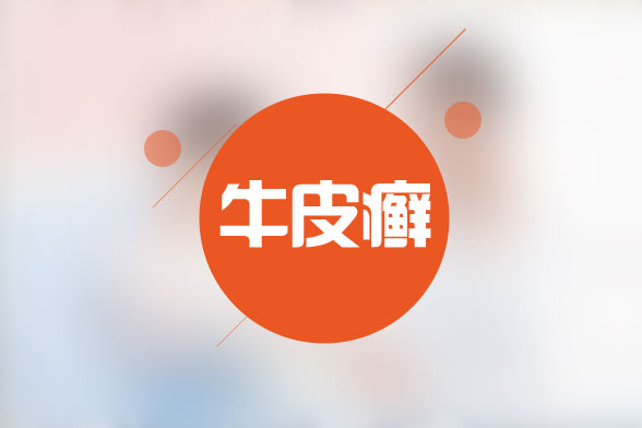 牛皮癬病人在飲食有哪些注意事項？