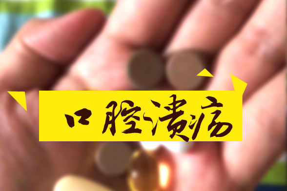 口腔潰瘍精神壓力是病因！四種小方法幫您治療口腔潰瘍