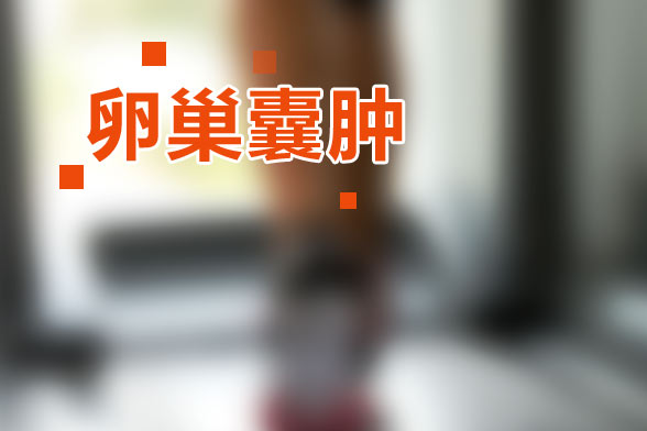 非腫瘤性卵巢囊腫是什么？非腫瘤性卵巢囊腫有哪些癥狀？