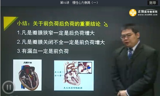 心力衰竭基本病因詳細講解