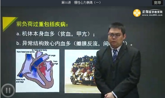 心力衰竭基本病因詳細講解