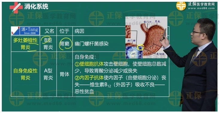 -食管、胃、十二指腸疾病